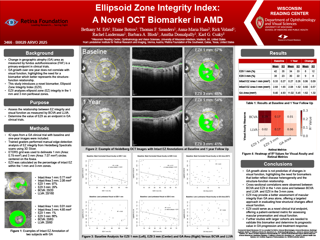 Research poster titled “Ellipsoid Zone Integrity Index: A Novel OCT Biomarker in AMD” presented at ARVO 2025 by Erb, et al. 