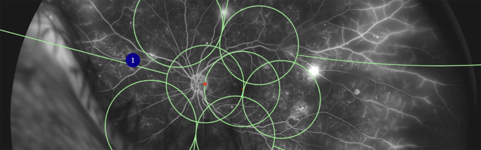 Ocular Banner